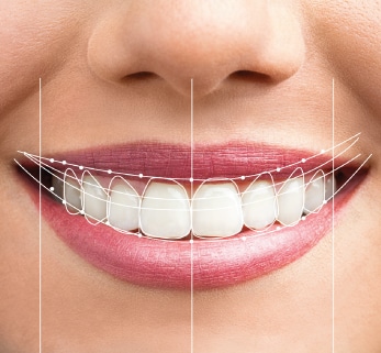 Cosmetic Dentistry in Deira Dubai