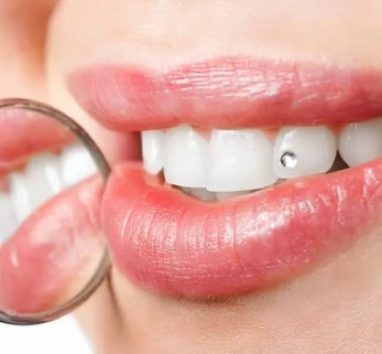 Cosmetic dentist in Deira Dubai