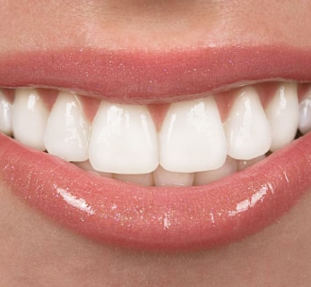 Cosmetic dentist in Deira Dubai