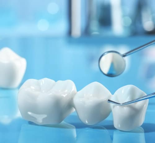 Best Gum Surgery in Dubai