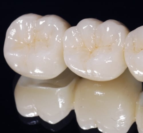 Gum Surgery in Dubai