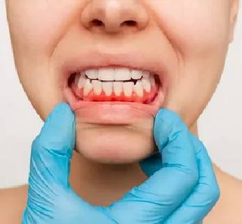 Re-treatment in Dubai