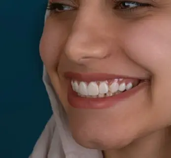 Re-treatment in Dubai