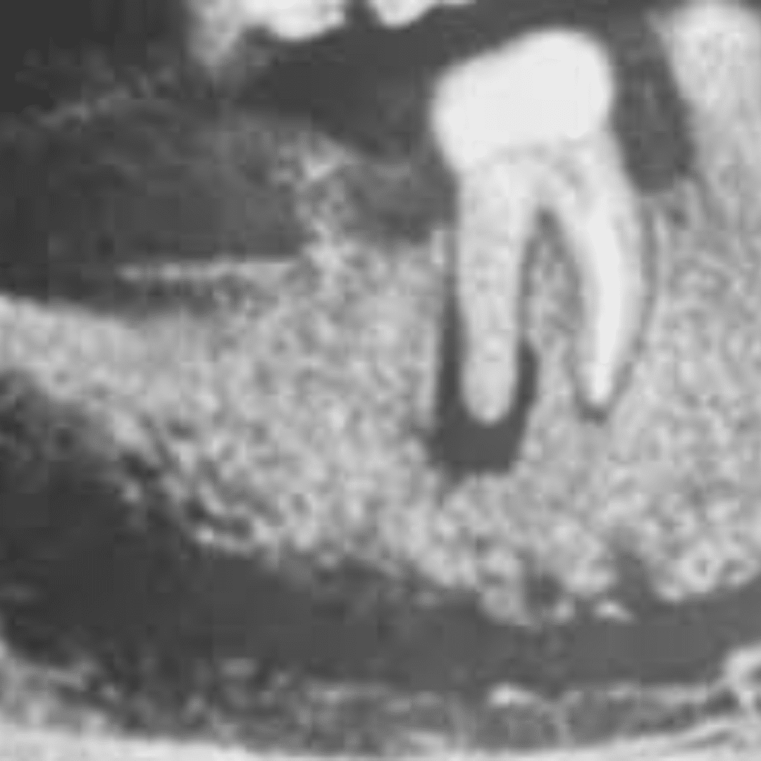 Re-treatment in Dubai