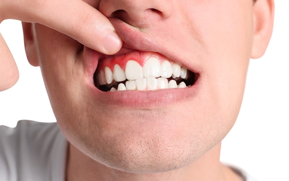 How Can a Gum Specialist Help Prevent Tooth Loss?