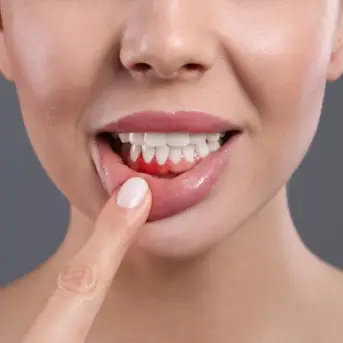 Re-treatment in Dubai